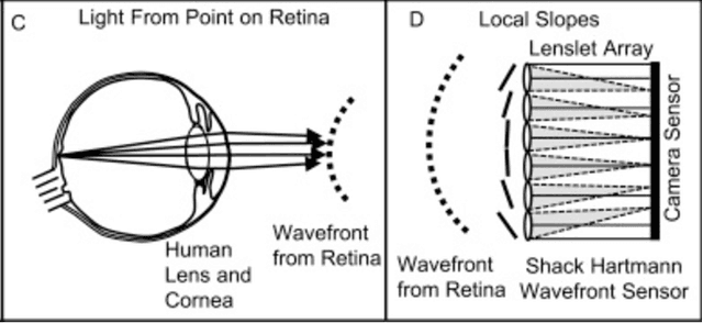 Figure 4 for The Concurrent Use of Medical Imaging Modalities and Innovative Treatments to Combat Retinitis Pigmentosa
