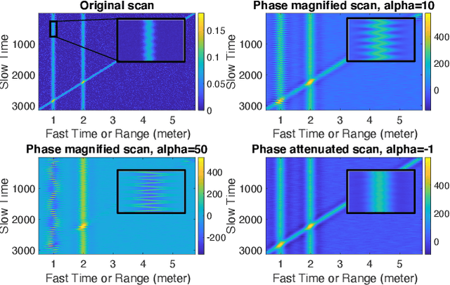 Figure 2 for Eulerian Phase-based Motion Magnification for High-Fidelity Vital Sign Estimation with Radar in Clinical Settings