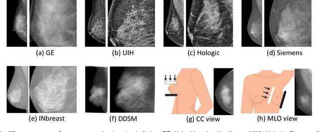 Figure 2 for Domain Generalization for Mammographic Image Analysis via Contrastive Learning