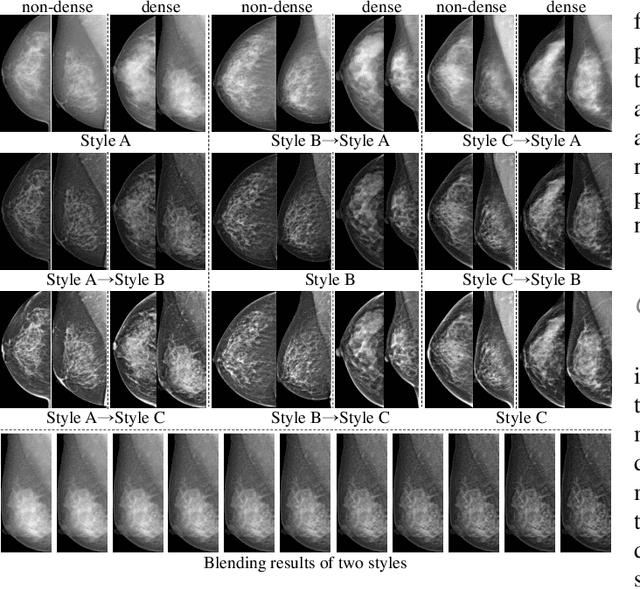Figure 4 for Domain Generalization for Mammographic Image Analysis via Contrastive Learning