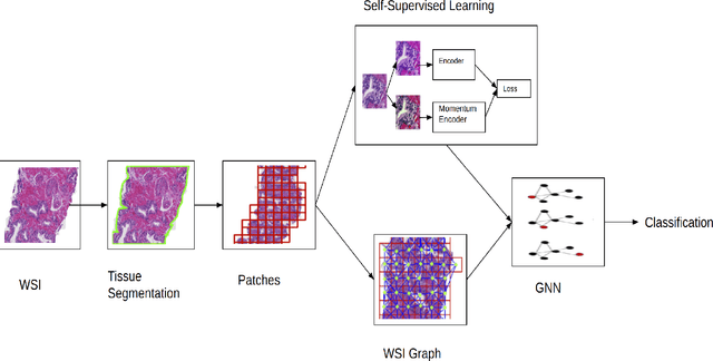 Figure 1 for Context-Aware Self-Supervised Learning of Whole Slide Images