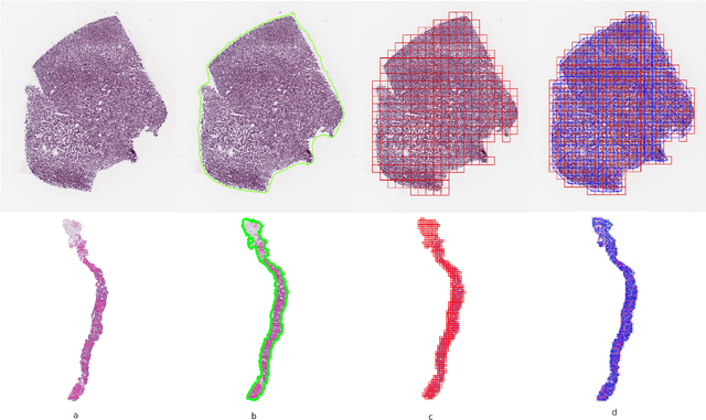 Figure 2 for Context-Aware Self-Supervised Learning of Whole Slide Images