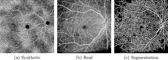 Figure 3 for Automated analysis of diabetic retinopathy using vessel segmentation maps as inductive bias