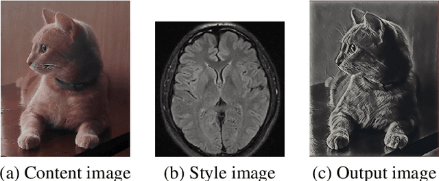 Figure 3 for Efficient Scopeformer: Towards Scalable and Rich Feature Extraction for Intracranial Hemorrhage Detection