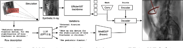 Figure 3 for FluoroSAM: A Language-aligned Foundation Model for X-ray Image Segmentation