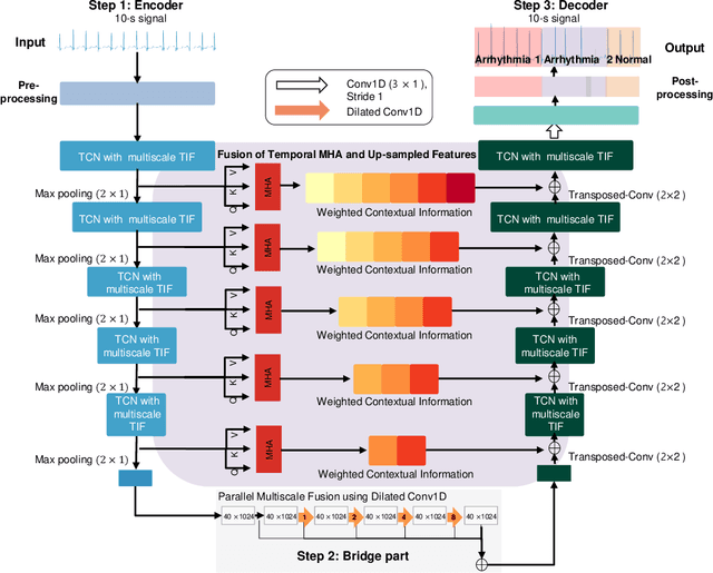 Figure 2 for Local-Global Temporal Fusion Network with an Attention Mechanism for Multiple and Multiclass Arrhythmia Classification