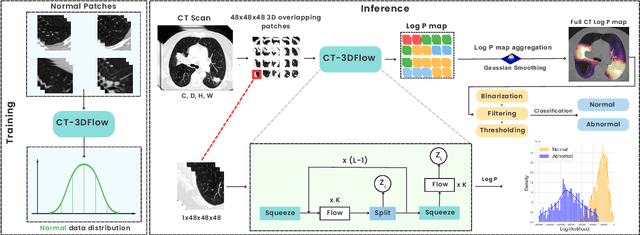 Figure 1 for CT-3DFlow : Leveraging 3D Normalizing Flows for Unsupervised Detection of Pathological Pulmonary CT scans