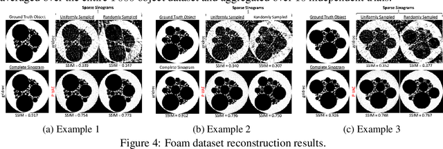 Figure 4 for A Self-Supervised Approach to Reconstruction in Sparse X-Ray Computed Tomography