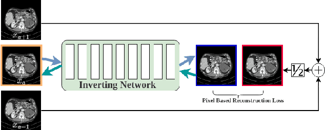 Figure 1 for Self Supervised Low Dose Computed Tomography Image Denoising Using Invertible Network Exploiting Inter Slice Congruence