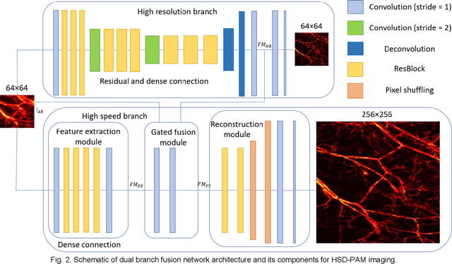 Figure 2 for HSD-PAM: High Speed Super Resolution Deep Penetration Photoacoustic Microscopy Imaging Boosted by Dual Branch Fusion Network