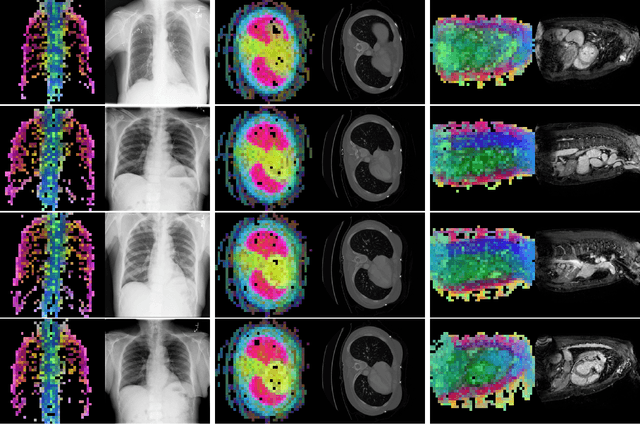 Figure 1 for Towards General Purpose Vision Foundation Models for Medical Image Analysis: An Experimental Study of DINOv2 on Radiology Benchmarks