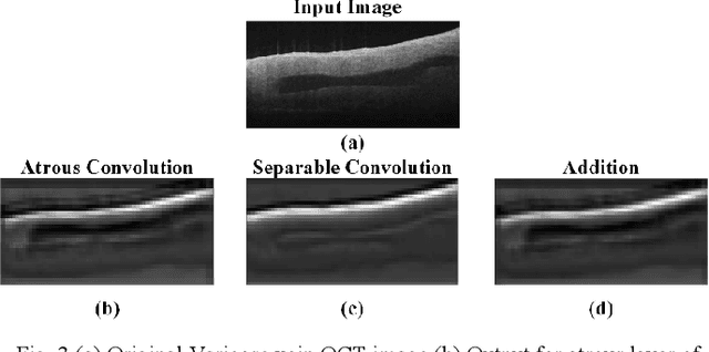 Figure 2 for Opto-UNet: Optimized UNet for Segmentation of Varicose Veins in Optical Coherence Tomography