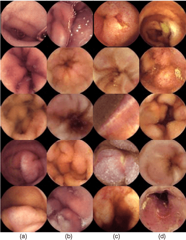 Figure 3 for This Intestine Does Not Exist: Multiscale Residual Variational Autoencoder for Realistic Wireless Capsule Endoscopy Image Generation