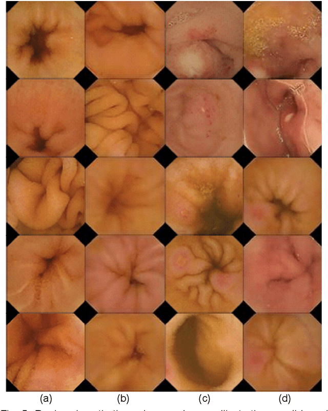 Figure 4 for This Intestine Does Not Exist: Multiscale Residual Variational Autoencoder for Realistic Wireless Capsule Endoscopy Image Generation