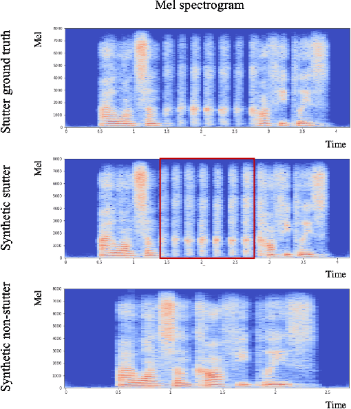 Figure 4 for Stutter-TTS: Controlled Synthesis and Improved Recognition of Stuttered Speech