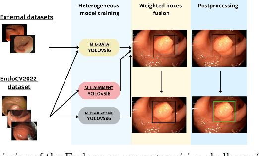 Figure 1 for Sources of performance variability in deep learning-based polyp detection