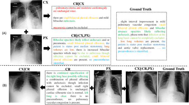Figure 3 for TiBiX: Leveraging Temporal Information for Bidirectional X-ray and Report Generation