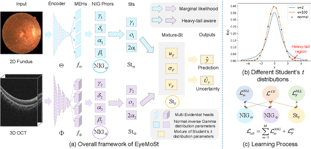 Figure 1 for Reliable Multimodality Eye Disease Screening via Mixture of Student's t Distributions