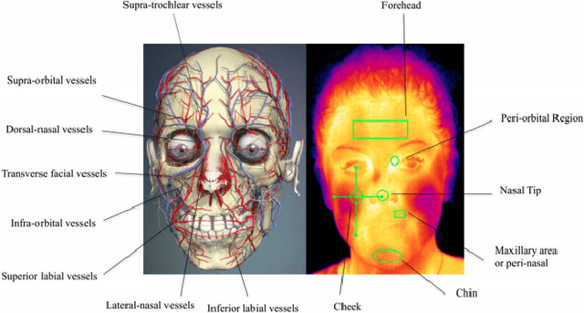 Figure 3 for When Visible-to-Thermal Facial GAN Beats Conditional Diffusion