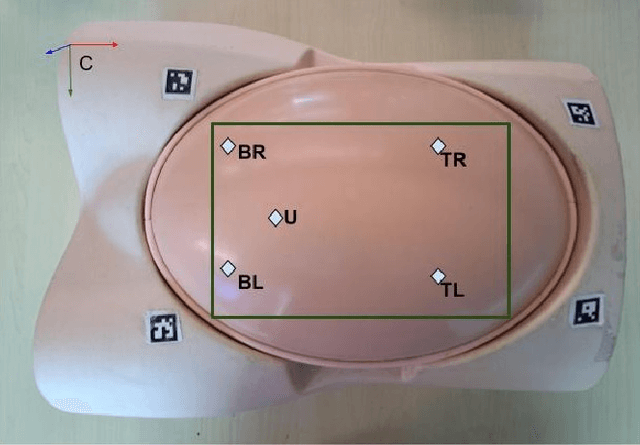 Figure 4 for Immersive Virtual Reality Platform for Robot-Assisted Antenatal Ultrasound Scanning