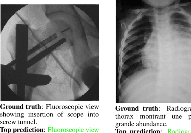 Figure 4 for Increasing Textual Context Size Boosts Medical Image-Text Matching