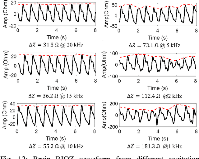 Figure 4 for BrainZ-BP: A Non-invasive Cuff-less Blood Pressure Estimation Approach Leveraging Brain Bio-impedance and Electrocardiogram