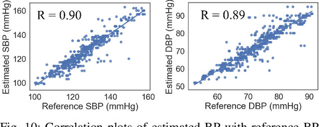 Figure 2 for BrainZ-BP: A Non-invasive Cuff-less Blood Pressure Estimation Approach Leveraging Brain Bio-impedance and Electrocardiogram