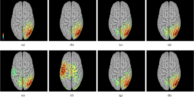 Figure 3 for BiCurNet: Pre-Movement EEG based Neural Decoder for Biceps Curl Trajectory Estimation
