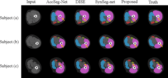 Figure 4 for Single Slice Thigh CT Muscle Group Segmentation with Domain Adaptation and Self-Training