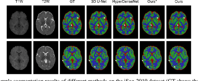 Figure 4 for Uncertainty-Aware Multi-Parametric Magnetic Resonance Image Information Fusion for 3D Object Segmentation