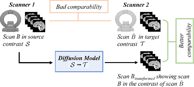 Figure 1 for Diffusion Models for Contrast Harmonization of Magnetic Resonance Images