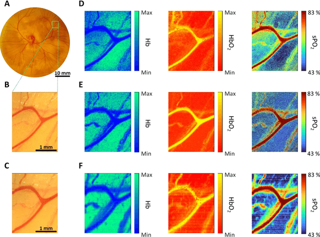 Figure 4 for mHealth hyperspectral learning for instantaneous spatiospectral imaging of hemodynamics