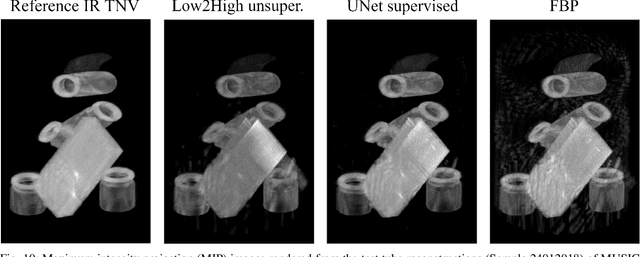Figure 2 for Unsupervised denoising for sparse multi-spectral computed tomography