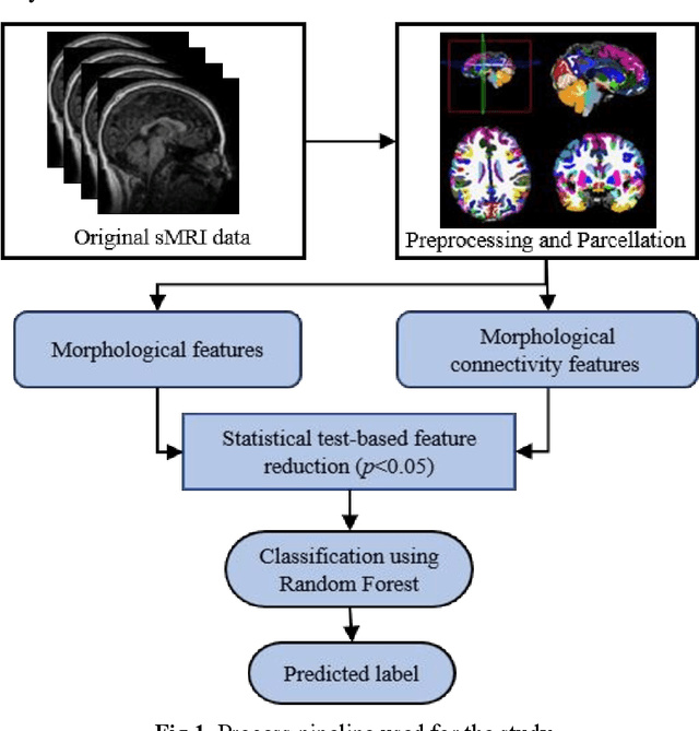 Figure 2 for Age-Stratified Differences in Morphological Connectivity Patterns in ASD: An sMRI and Machine Learning Approach