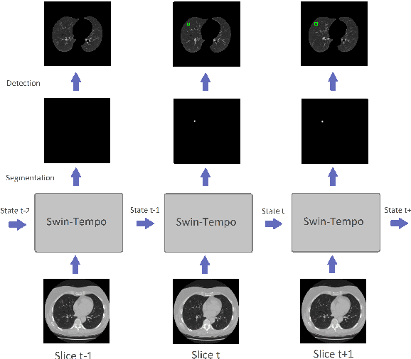 Figure 1 for Swin-Tempo: Temporal-Aware Lung Nodule Detection in CT Scans as Video Sequences Using Swin Transformer-Enhanced UNet