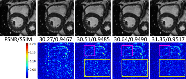 Figure 1 for Generalizable Deep Learning Method for Suppressing Unseen and Multiple MRI Artifacts Using Meta-learning