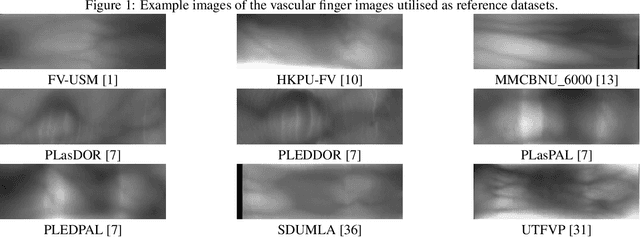 Figure 2 for Advanced Image Quality Assessment for Hand- and Fingervein Biometrics