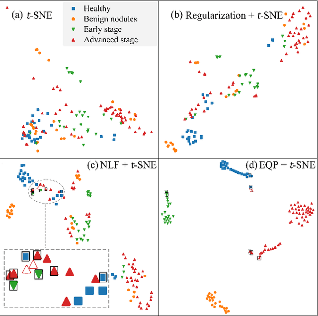 Figure 4 for Intelligent diagnostic scheme for lung cancer screening with Raman spectra data by tensor network machine learning