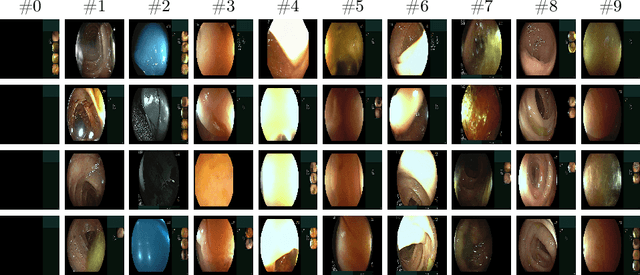 Figure 3 for Semi-supervised Quality Evaluation of Colonoscopy Procedures