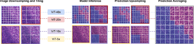 Figure 3 for Robust Tumor Detection from Coarse Annotations via Multi-Magnification Ensembles