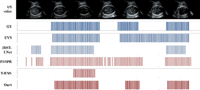 Figure 3 for Hierarchical Agent-based Reinforcement Learning Framework for Automated Quality Assessment of Fetal Ultrasound Video