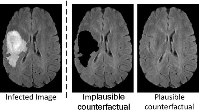 Figure 1 for Counterfactual Explanation and Instance-Generation using Cycle-Consistent Generative Adversarial Networks