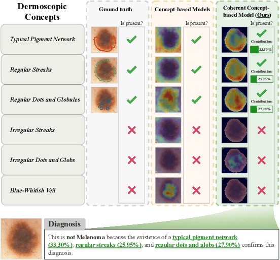 Figure 1 for Coherent Concept-based Explanations in Medical Image and Its Application to Skin Lesion Diagnosis