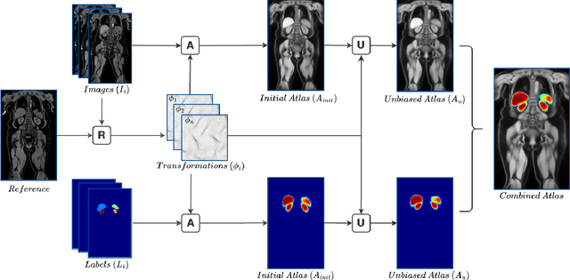 Figure 1 for Constructing Population-Specific Atlases from Whole Body MRI: Application to the UKBB