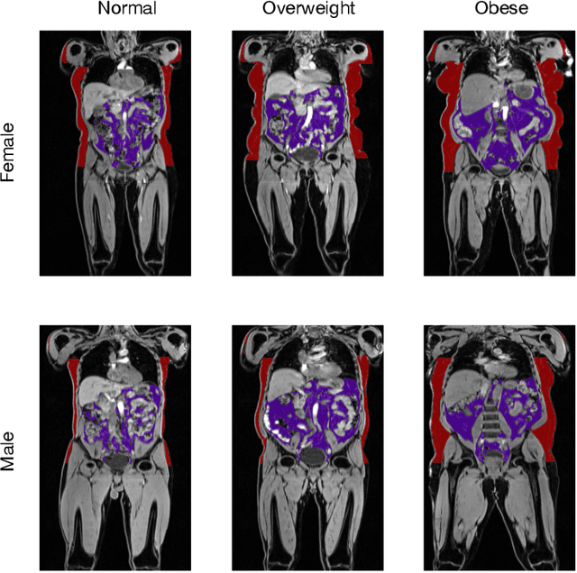 Figure 3 for Constructing Population-Specific Atlases from Whole Body MRI: Application to the UKBB