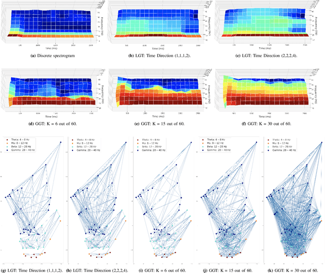 Figure 4 for Graph Neural Networks on SPD Manifolds for Motor Imagery Classification: A Perspective from the Time-Frequency Analysis