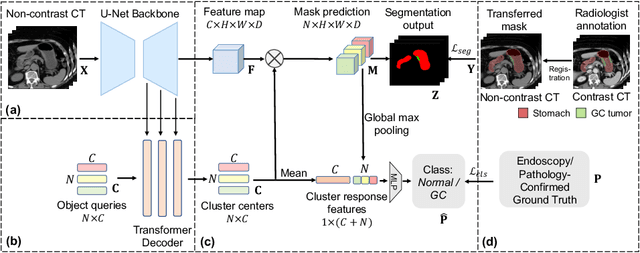 Figure 1 for Cluster-Induced Mask Transformers for Effective Opportunistic Gastric Cancer Screening on Non-contrast CT Scans