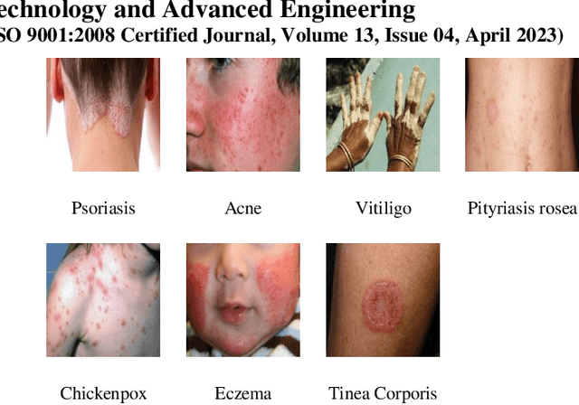 Figure 1 for Classification of Skin Disease Using Transfer Learning in Convolutional Neural Networks
