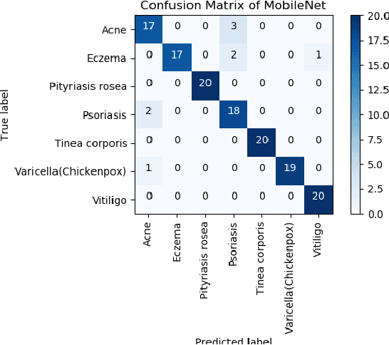 Figure 4 for Classification of Skin Disease Using Transfer Learning in Convolutional Neural Networks