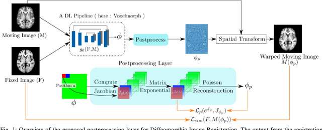 Figure 1 for Towards Positive Jacobian: Learn to Postprocess Diffeomorphic Image Registration with Matrix Exponential